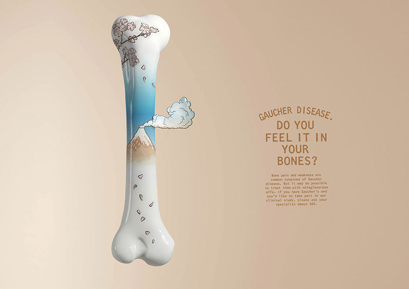 戈謝病臨床研究受試者招募廣告策劃設(shè)計(jì),畫(huà)面唯美中暗喻病痛折磨 戈謝病臨床研究受試者招募廣告策劃設(shè)計(jì),畫(huà)面唯美中暗喻病痛折磨