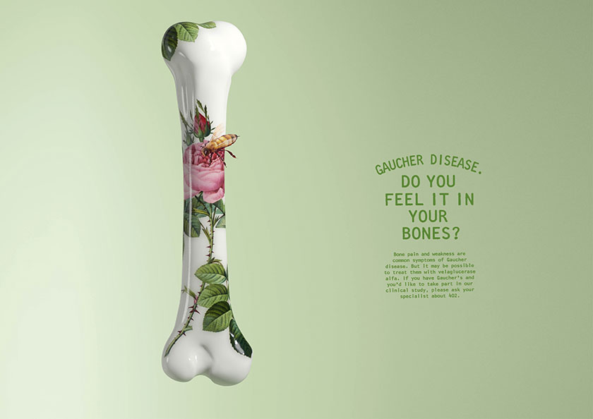 戈謝病臨床研究受試者招募廣告策劃設(shè)計(jì),畫(huà)面唯美中暗喻病痛折磨 戈謝病臨床研究受試者招募廣告策劃設(shè)計(jì),畫(huà)面唯美中暗喻病痛折磨