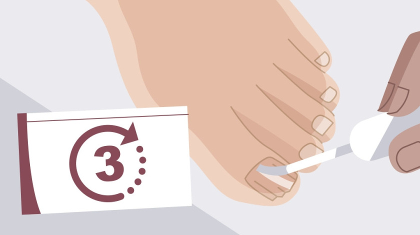 Nailner美甲修復(fù)劑真菌指甲治療藥品TVC二維動畫廣告策劃“7天見效” Nailner美甲修復(fù)劑真菌指甲治療藥品TVC二維動畫廣告策劃“7天見效”